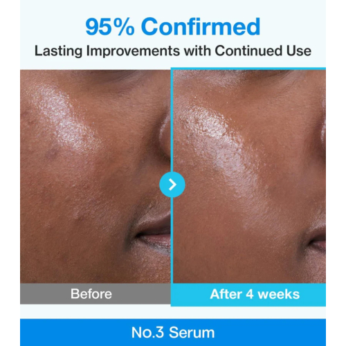 Numbuzin - Sérum minimizador de poros No.3 Blue Bio-Retinol