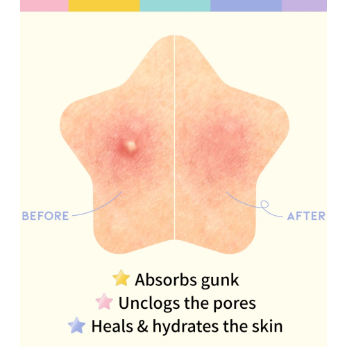 OOTD Beauty - Parches para granos en forma de estrella Star Spot Patch