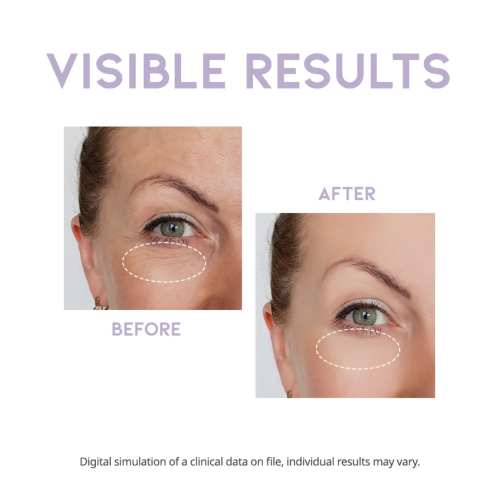 OOTD Beauty - Sérum para el contorno de los ojos de noche Overnight