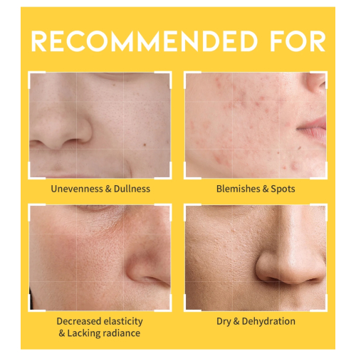 OOTD Beauty - Tónico iluminador Dark Spot Vitamin C