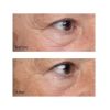 Perricone MD - *High Potency* - Sérum para el contorno de ojos reafirmante Growth Factor