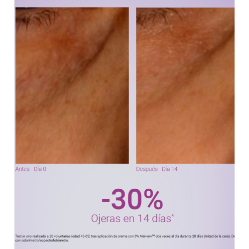 Primaderm - Contorno de ojos antiarrugas Xpert Expression Contour