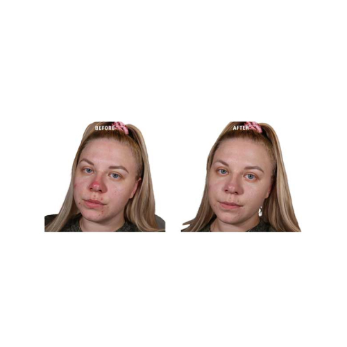 Revolution - Prebase de color en crema Superbase Colour Correcting - Green