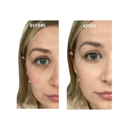 Revolution - Prebase de color en crema Superbase Colour Correcting - Yellow