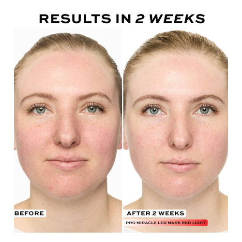 Revolution Pro - Mascarilla facial Miracle LED Face Mask