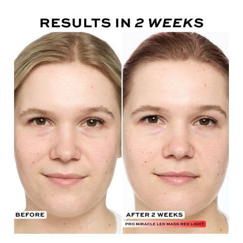 Revolution Pro - Mascarilla facial Miracle LED Face Mask