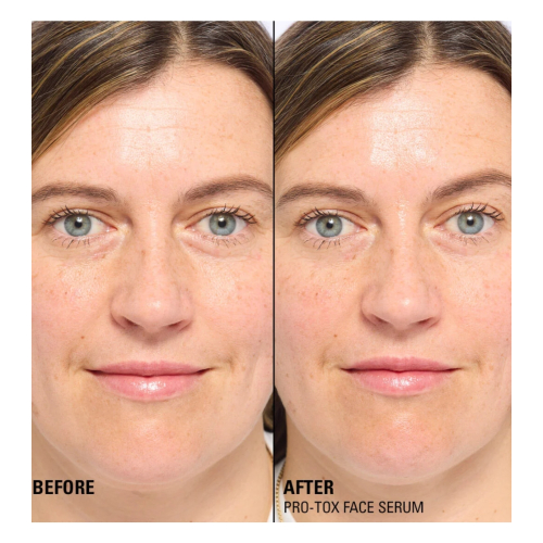 Revolution Pro - *Miracle Pro-Tox* - Sérum facial reparador y rellenador de líneas