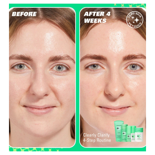 Revolution Skin - *Clearly Clarify* - Sérum facial clarificante 5% niacinamida y 2% ácido salicílico Clear Canvas