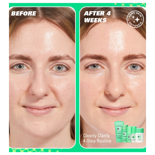 Revolution Skin - *Clearly Clarify* - Sérum facial clarificante 10% niacinamida Serum Supreme