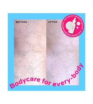 Revolution Skincare - *Body Skincare* - Sérum corporal AHA Bump Eraser