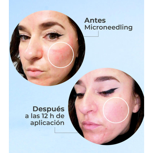 SEGLE - Sérum facial antiedad regenerador Skin Factor - Piel sensible