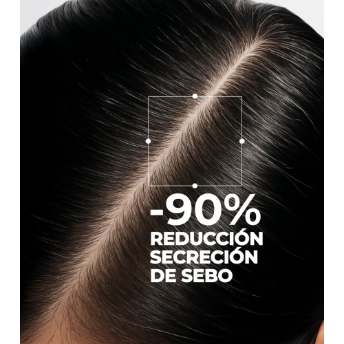 SEGLE - Sérum capilar Scalp Exfoliating
