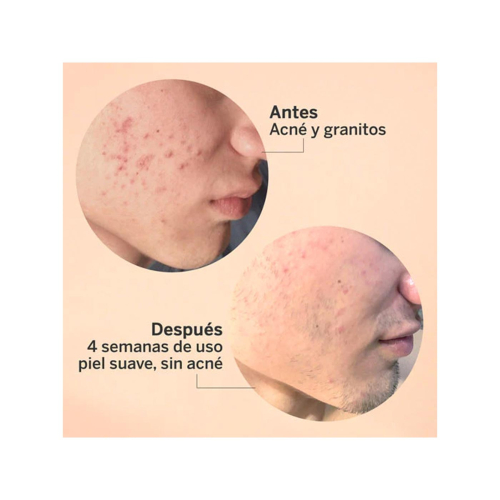 SEGLE - Sérum facial exfoliante AHA/BHA