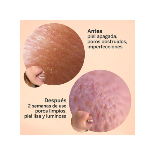 SEGLE - Serum facial exfoliante de ácido glicólico Glicolmix