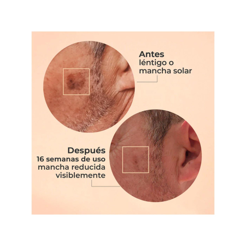 SEGLE - Serum facial exfoliante de ácido glicólico Glicolmix