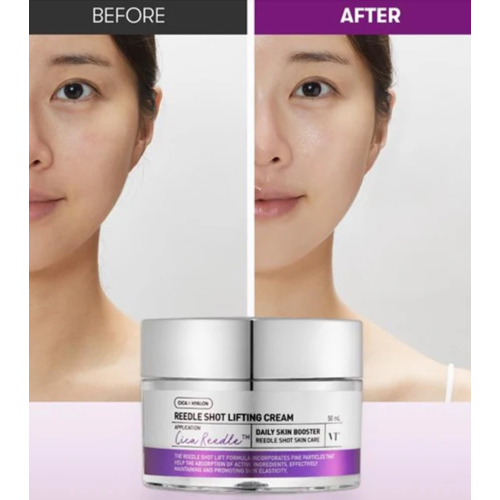 VT Cosmetics - Crema antiedad efecto lifting Reedle Shot