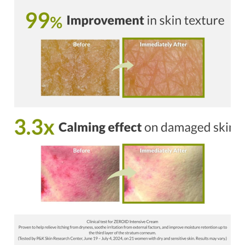 Zeroid - Crema intensiva reparadora